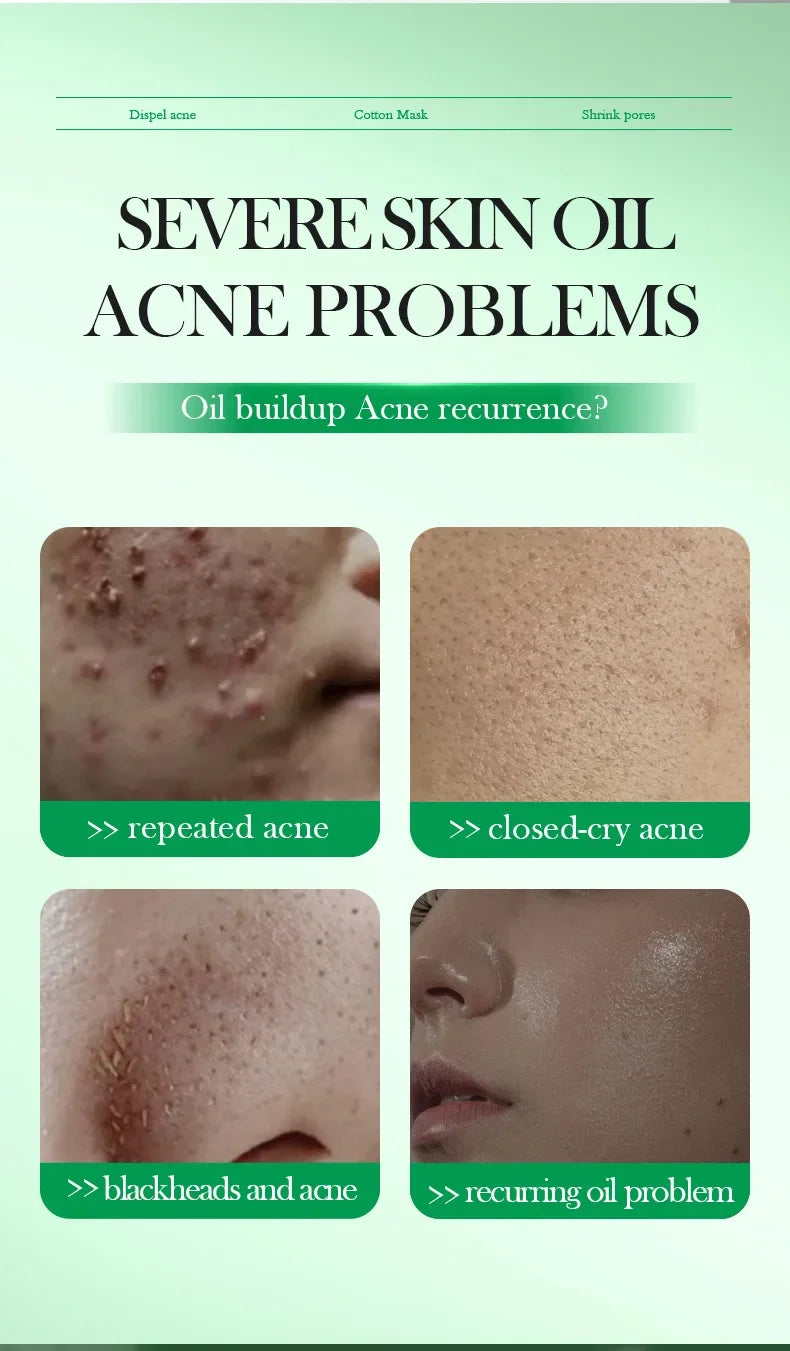 Salicylic Acid Cleansing Essence Lotion Moisturizing and Hydrating Face Cream Acne Amino Acid Skin Care Series