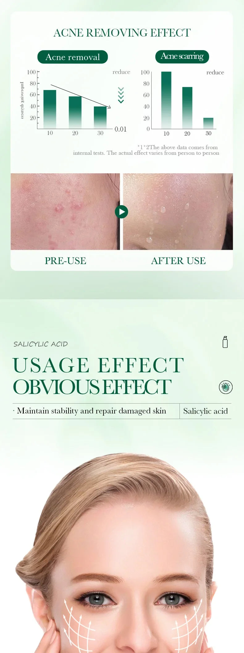 Salicylic Acid Cleansing Essence Lotion Moisturizing and Hydrating Face Cream Acne Amino Acid Skin Care Series