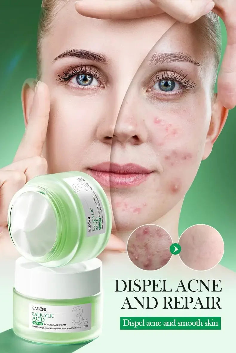 Salicylic Acid Cleansing Essence Lotion Moisturizing and Hydrating Face Cream Acne Amino Acid Skin Care Series